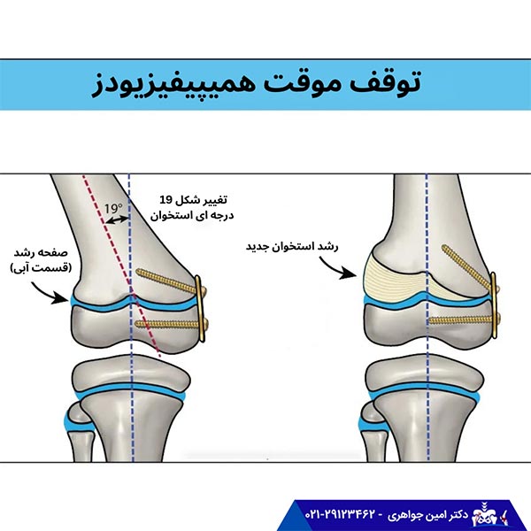 رشد هدایت شده