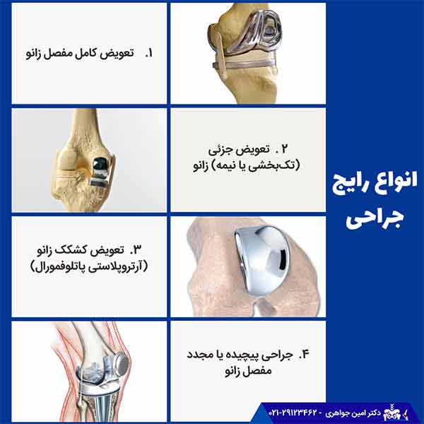 انواع رایج جراحی