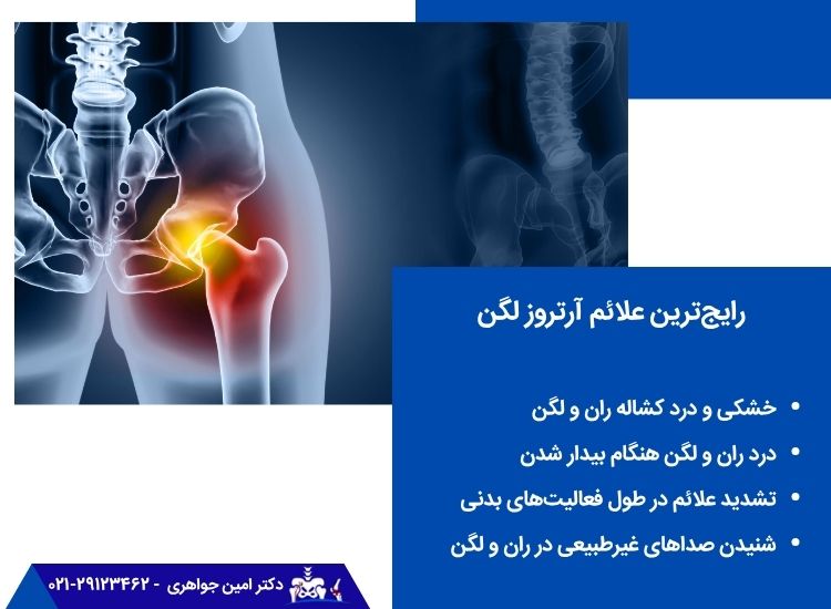 علائم آرتروز لگن