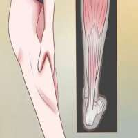 درد ساق پا - علائم و علت