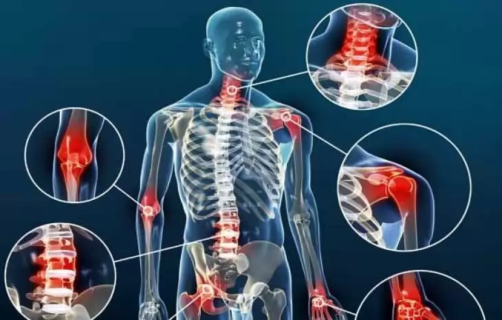 آیا آرتروز درمان قطعی دارد؟