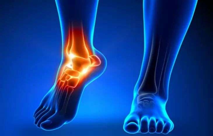 فیزیوتراپی پا و مچ پا چگونه است؟