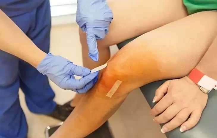 عفونت بعد از عمل تعویض مفصل زانو