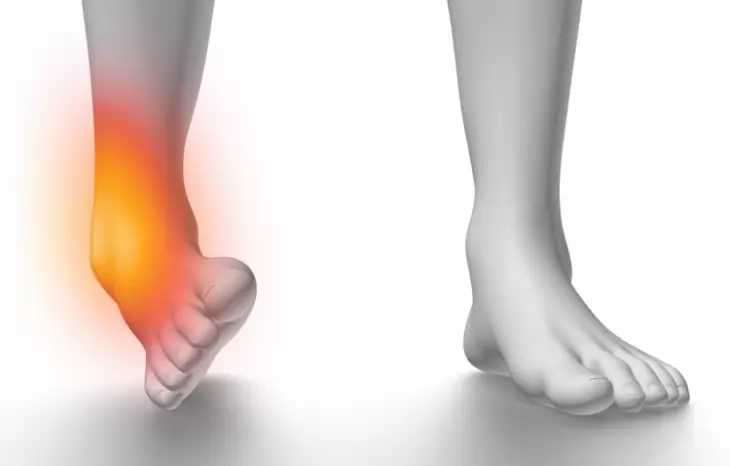 پیچ خوردگی مچ پا به چه علت ایجاد می شود و درمانش چیست؟