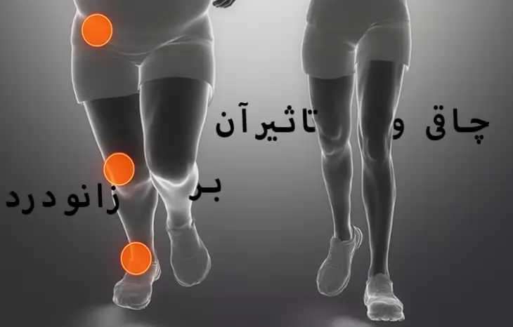 آیا چاقی و اضافه وزن باعث زانو درد می شود؟