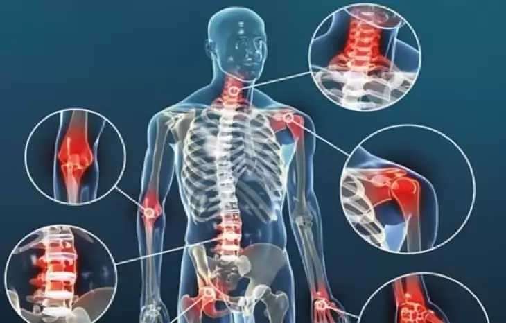 سوالات متداول درباره بیماری های مفصلی