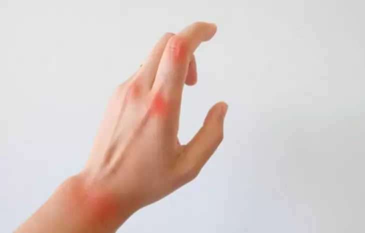 علت خشکی مفصل و راه های مقابله با آن